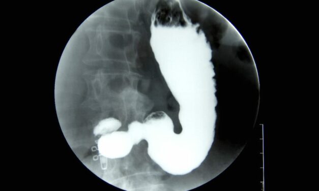 Enhancing Diagnostic Precision: The Role of Fluoroscopy in Gastroenterology