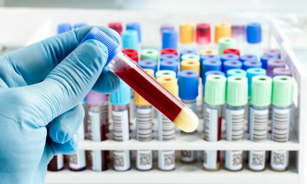 Interpreting Gastrointestinal Lab Tests: A Guide for Clinicians